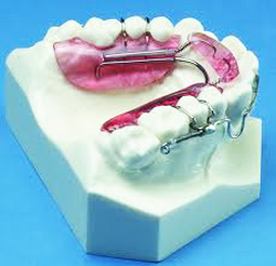 Inman Aligner