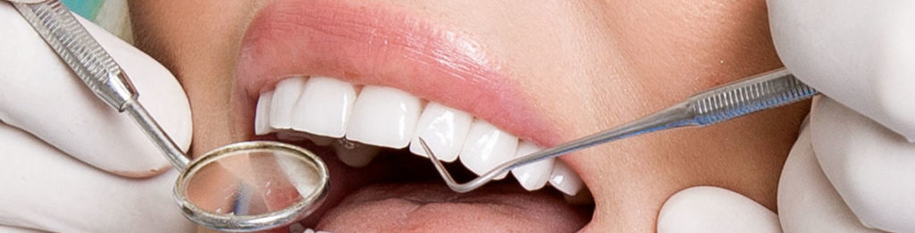 Dental Veneers Horsham - Young beautiful woman with beautiful white teeth sitting on a dental chair.